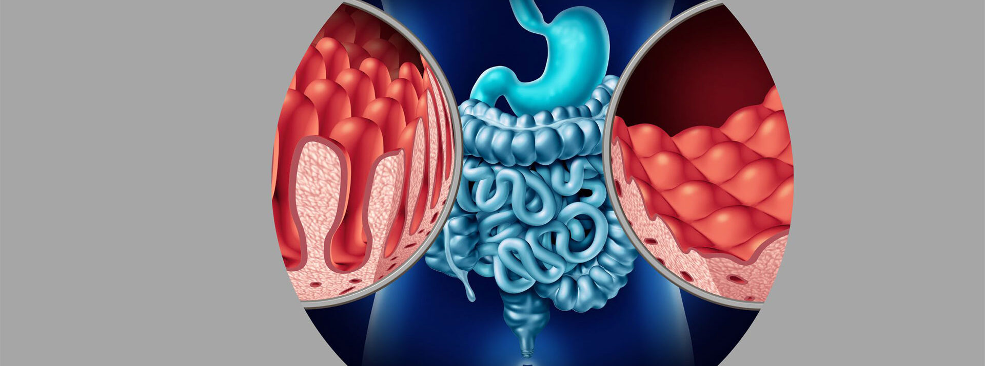 Lifestyle Disease Treatments