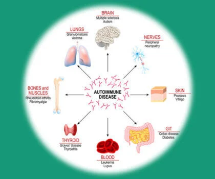Autoimmune conditions